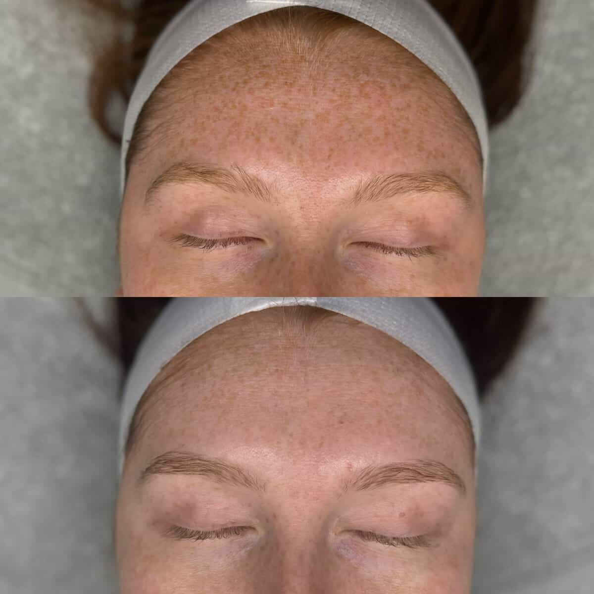 Read more about the article How UV Damage Your Skin?