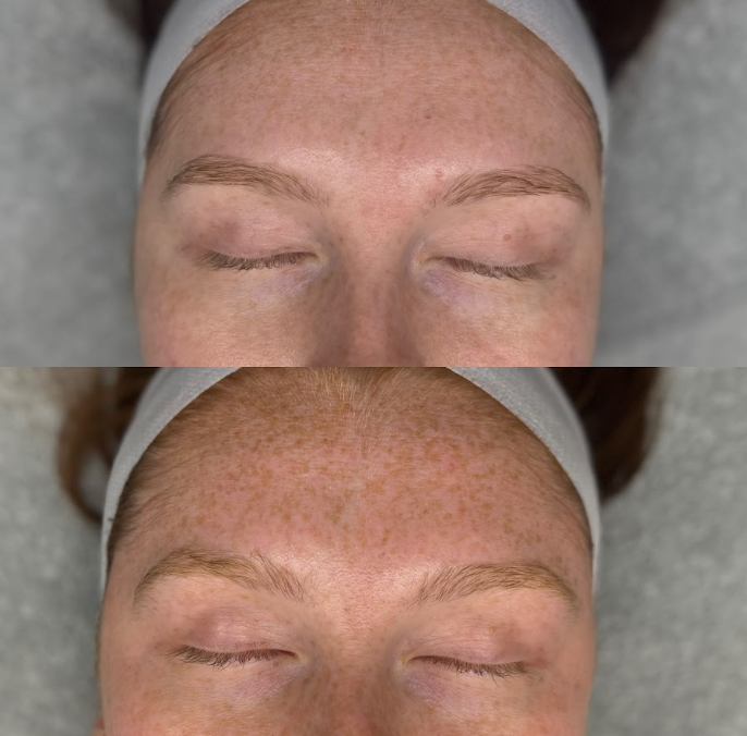 Read more about the article How UV Damage Your Skin? and Why Sunscreen Is the Most Important Anti-Aging Product You Own