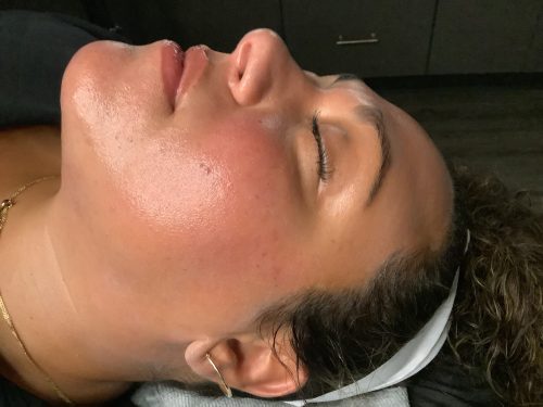 Dermaplane